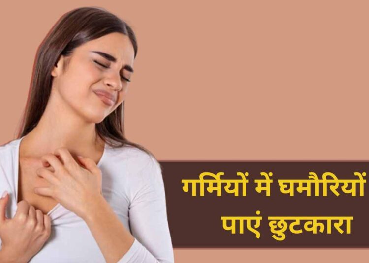 घमौरियों