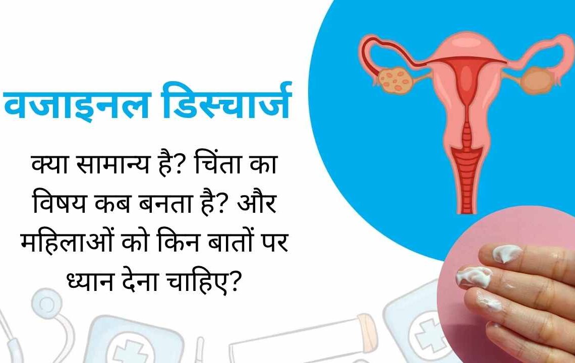 वजाइनल डिस्चार्ज