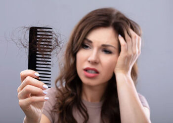 Hairloss Problem