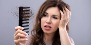Hairloss Problem