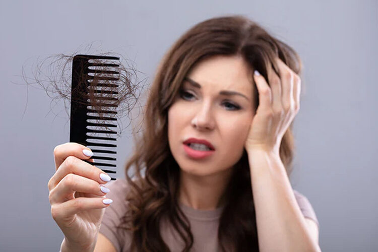 Hairloss Problem